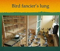 Bird Fancyiers Lung